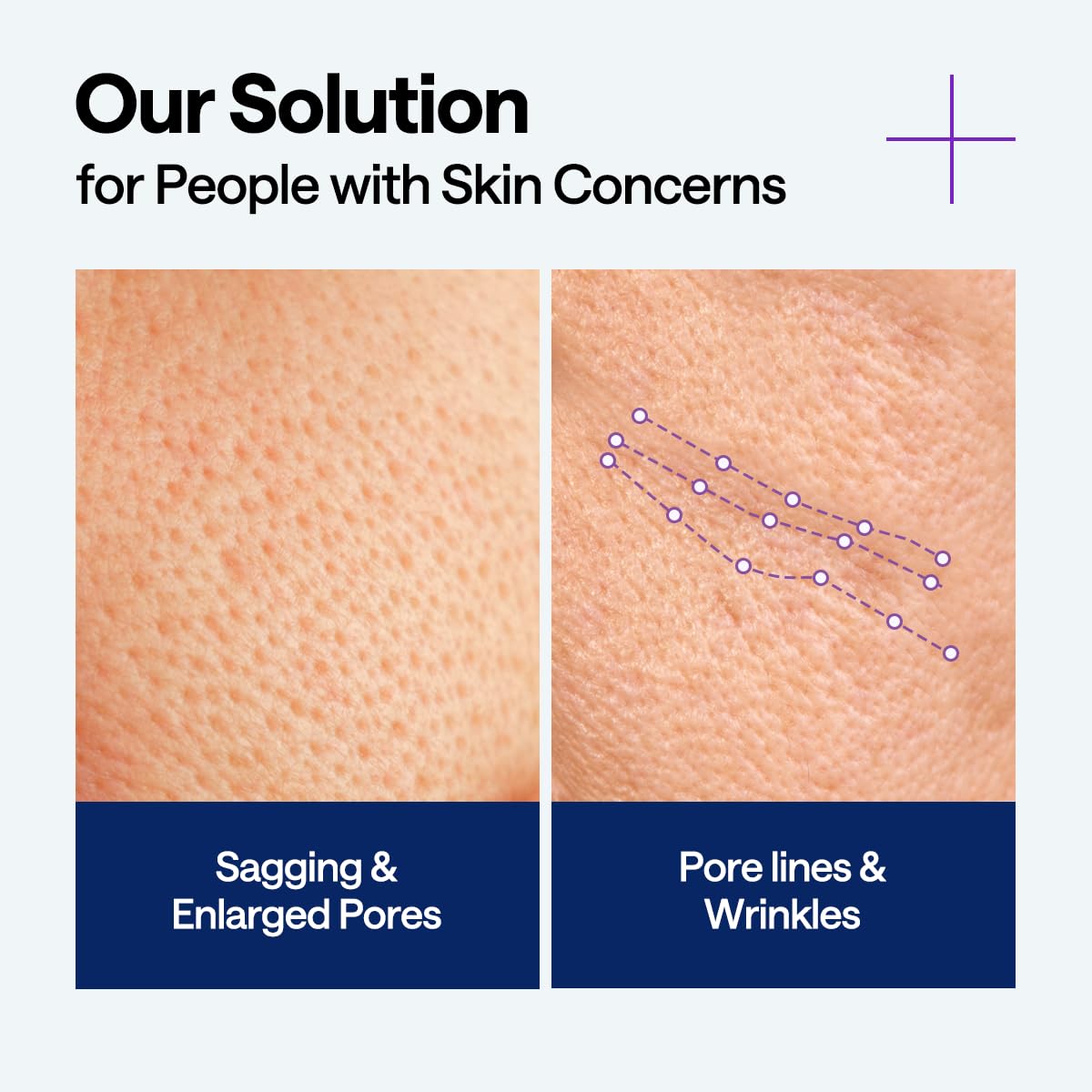 Mediheal PDRN Elevación Serum, dosificación precisa para uso diario y control de poros.