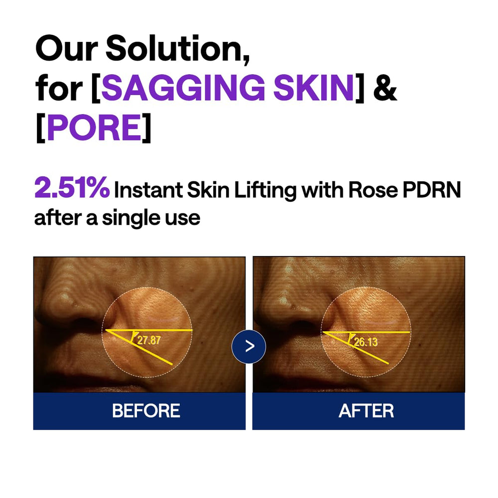 Mediheal PDRN Elevación Serum, ingredientes clave fortalecen hidratación y soporte natural.