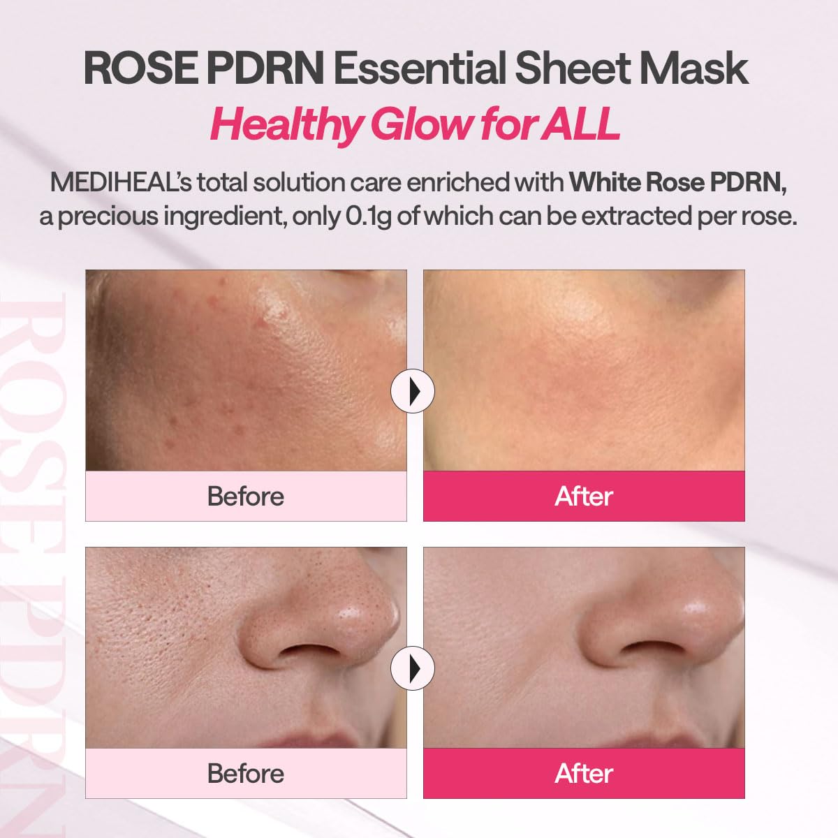 Mediheal Rose PDRN sheet mask texture looks smooth and comfortable.