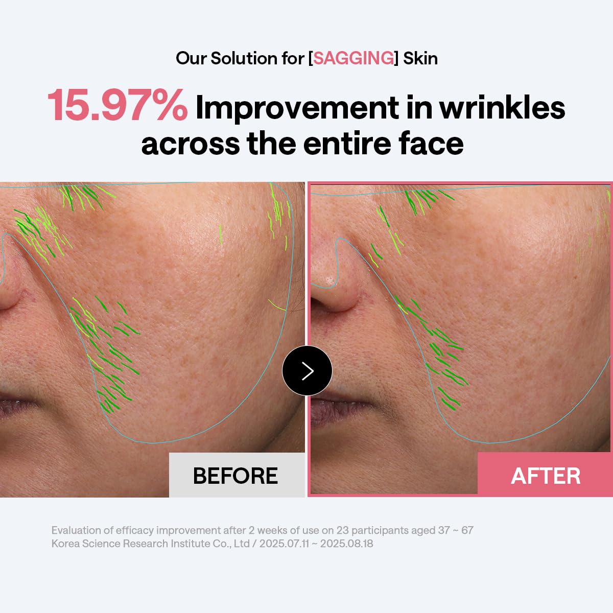 Mediheal Toner Pads pad-on-face close-up demonstrating quick application.
