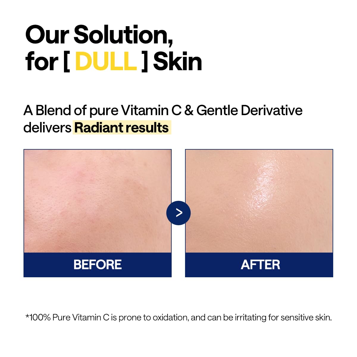 Mediheal vitamina C se aplica tras limpieza para mejorar tono y textura