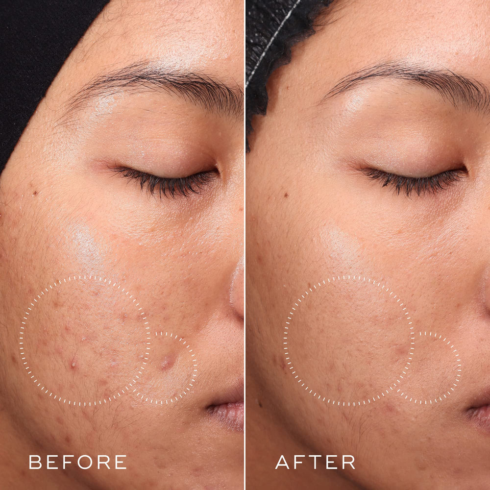 Ingredients list highlight of Medik8 Press and Clear toner for sensitive skin.