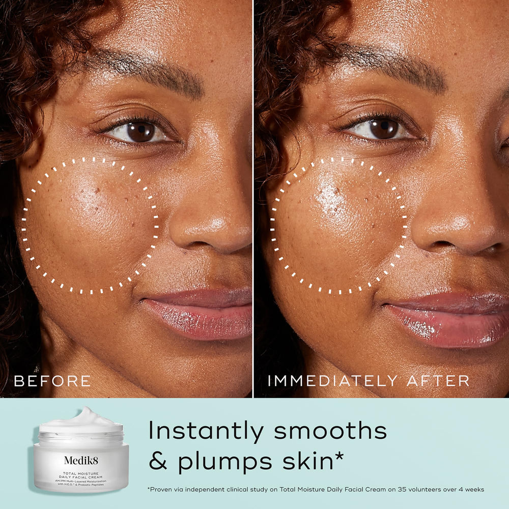 Hyaluronic acid in Medik8 Total Moisture visibly boosts plumpness.