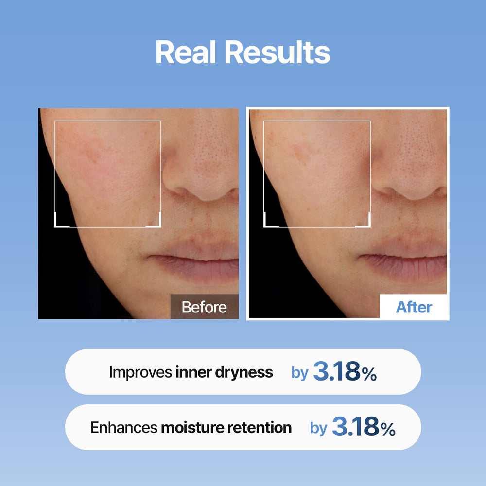 Meditherapy serum applied to cheek showing plump, hydrated skin