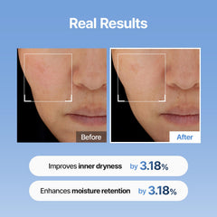 Meditherapy serum applied to cheek showing plump, hydrated skin