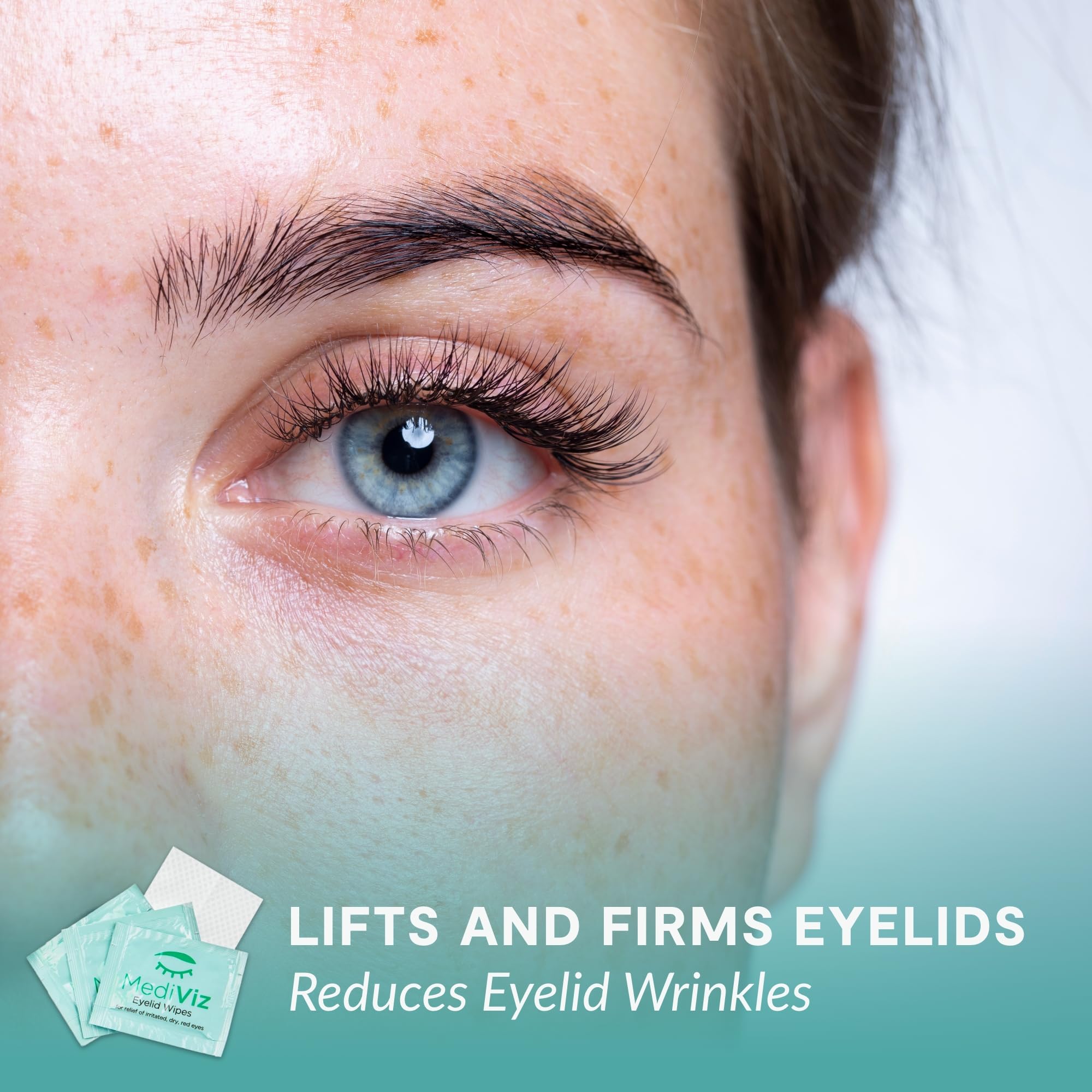 MEDIVIZ Eyelid Cleanser Wipes in use on the eyelid during application