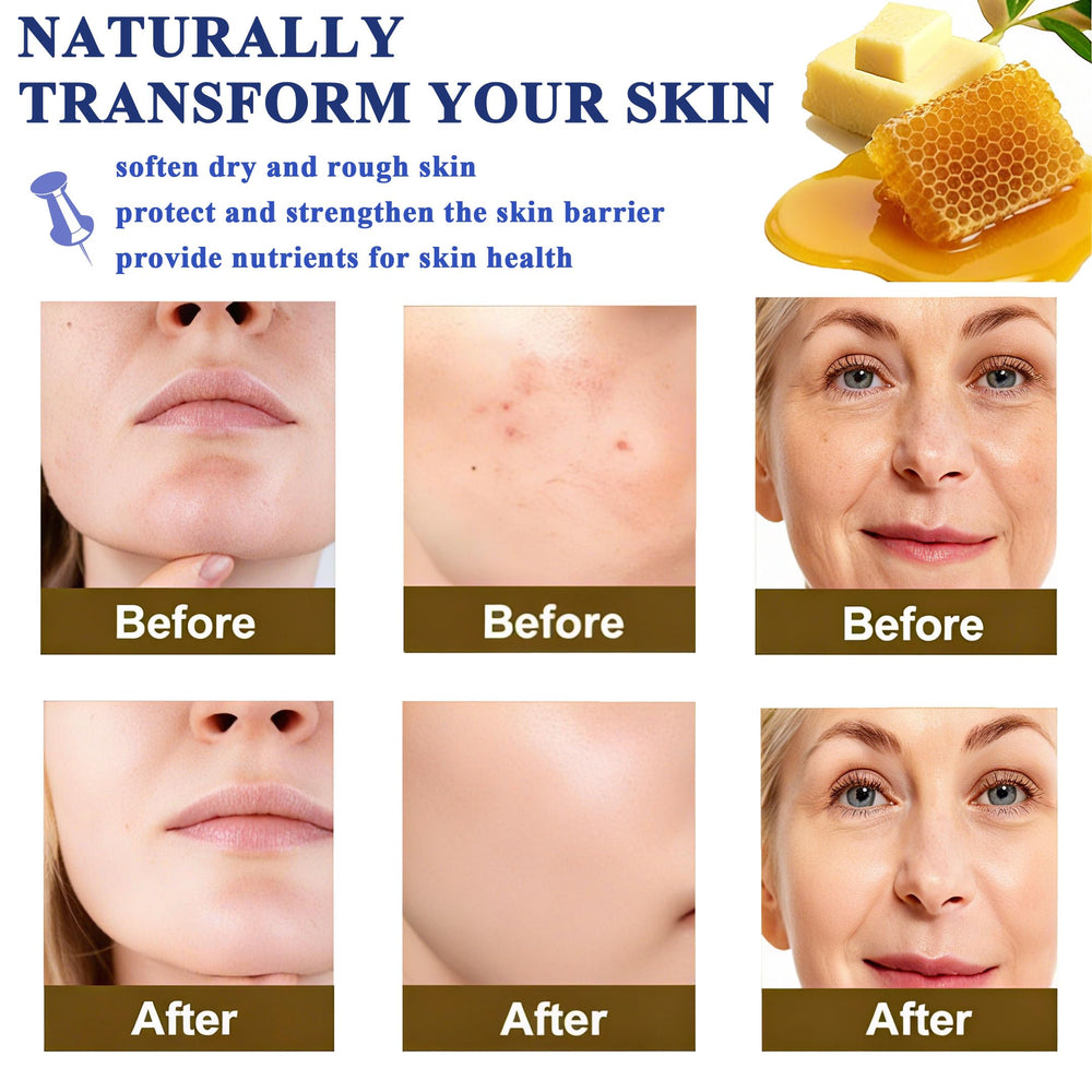 MediVuse balm on the body targets elbows and heels for smoothness