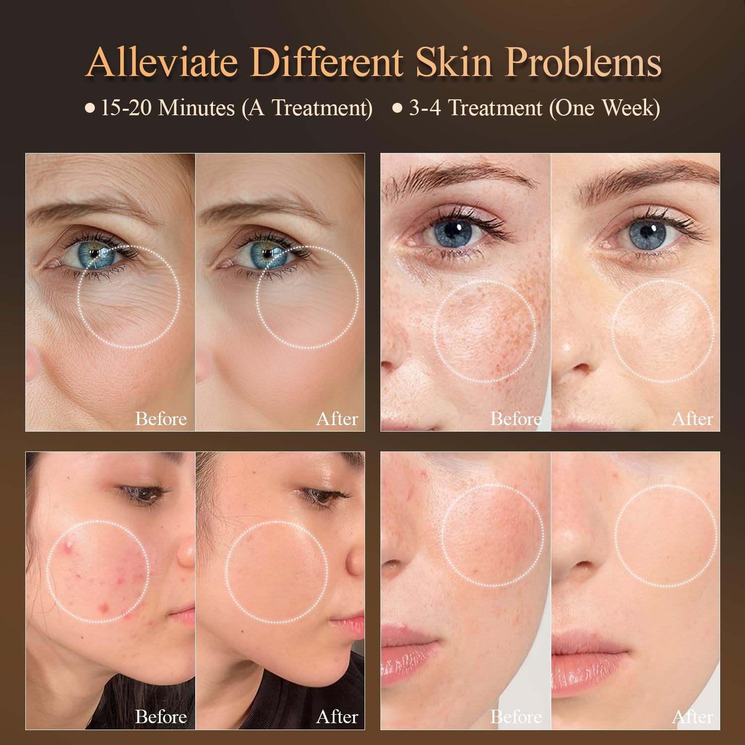 MEGELIN 7 wavelengths guide personalized skincare routines.