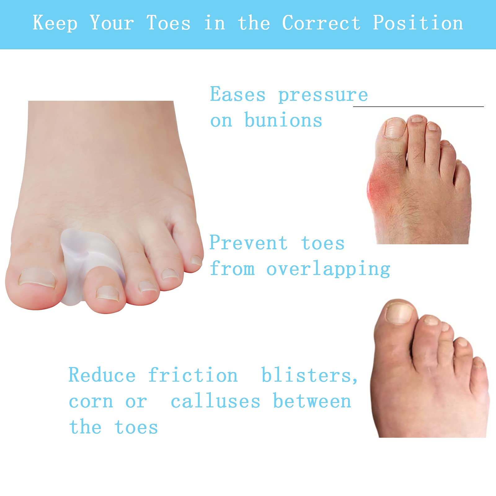 MENOCADY gel toe spacer closeup shows 1/4 inch spacing for gentle toe alignment.