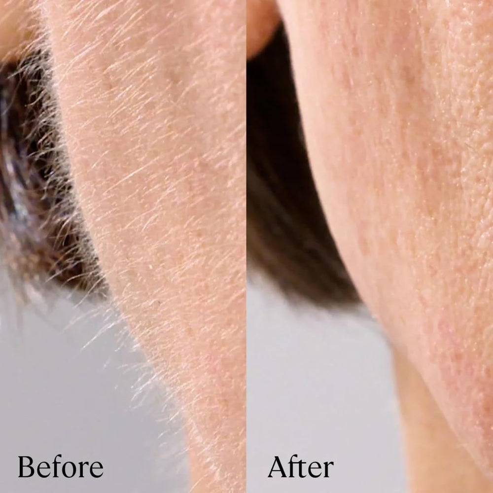 Sonicsmooth Pro+ used on skin for gentle exfoliation.