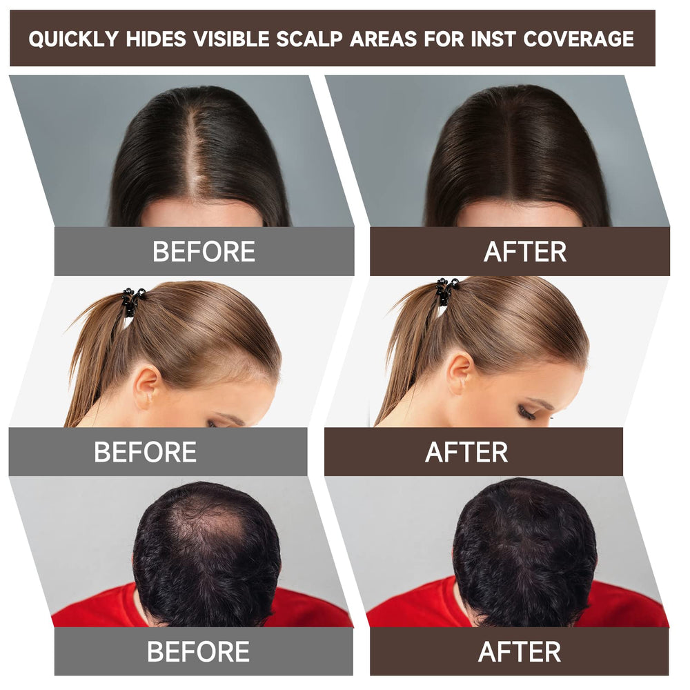 Mifeloy compact design delivering seamless blending with natural look