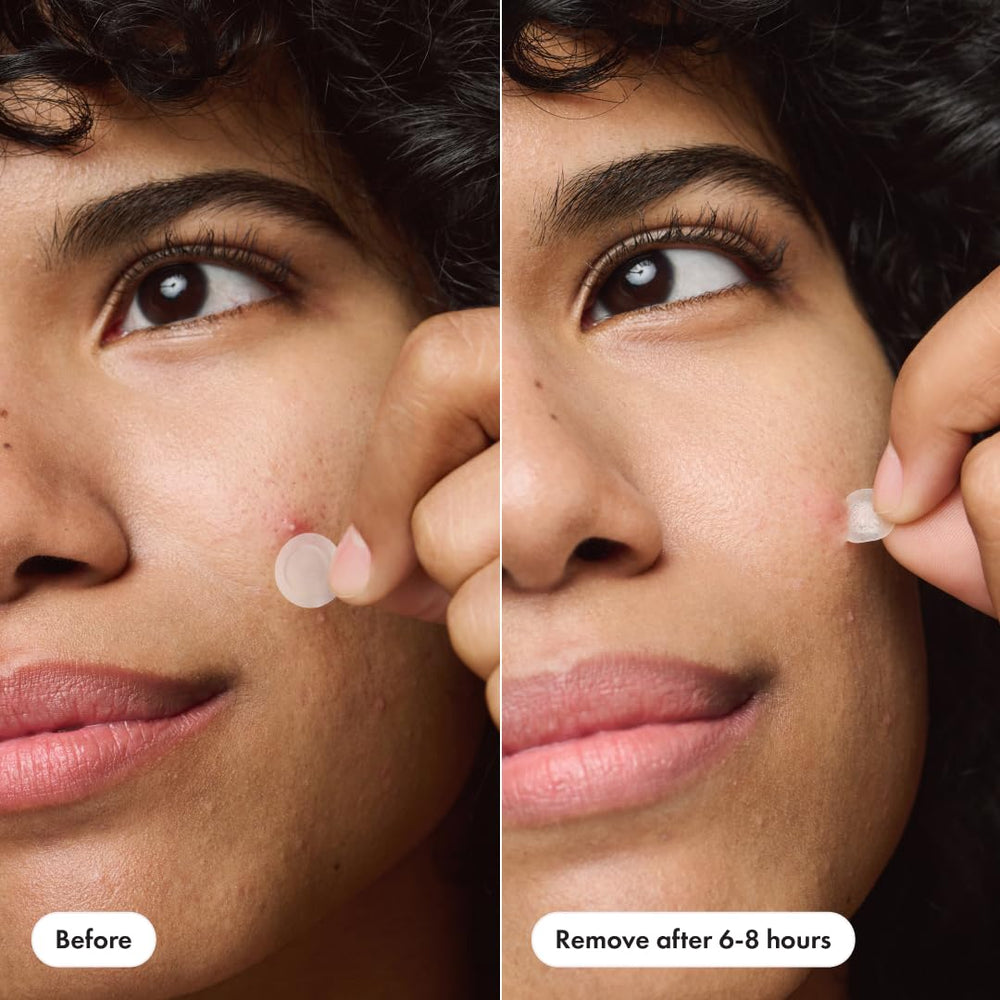 Mighty Patch Invisible+ strong adhesive keeps patches securely in place all day.