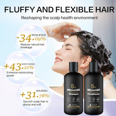 Minoxidil Conditioner bottle shows hydrating care for softer, more manageable hair.