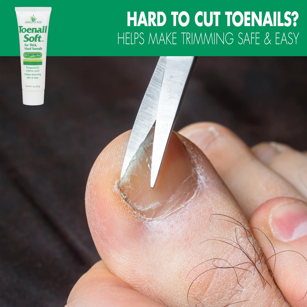 Miracle of Aloe crema para uñas gruesas, lista para recortar con suavidad.