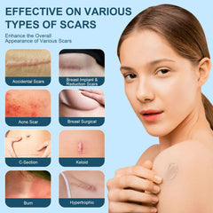 Mitgary Advanced Scar Gel ready to apply on face and body for scar care.