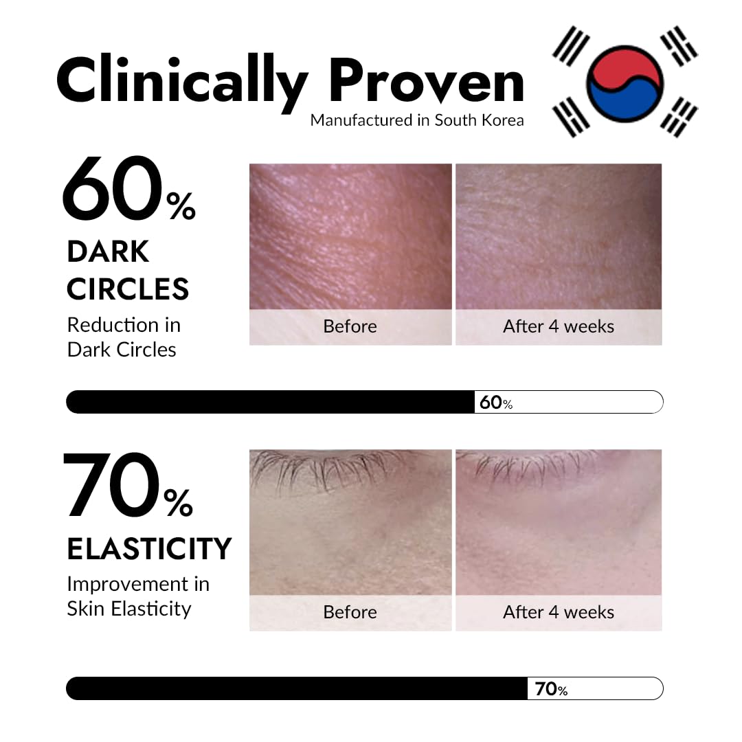 MIZON snail slime eye patch nourishes delicate skin around the eyes.