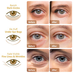 MLDWYH parches ojos rosa, efecto calmante para ojos cansados