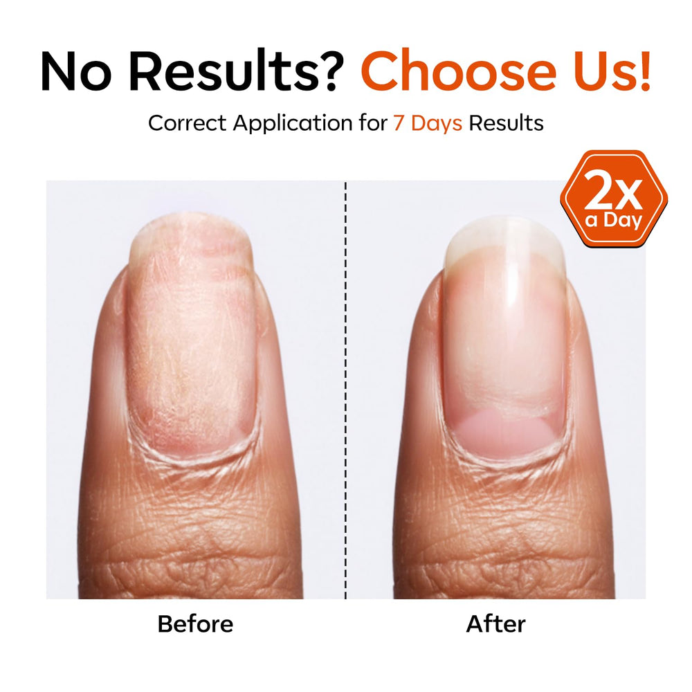 Long-lasting, chip-resistant base polish for salon-quality at home