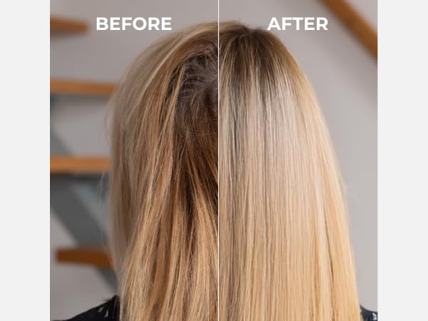 MOEV ANNURCATIN densidad capilar: sensación de cuerpo en el cabello