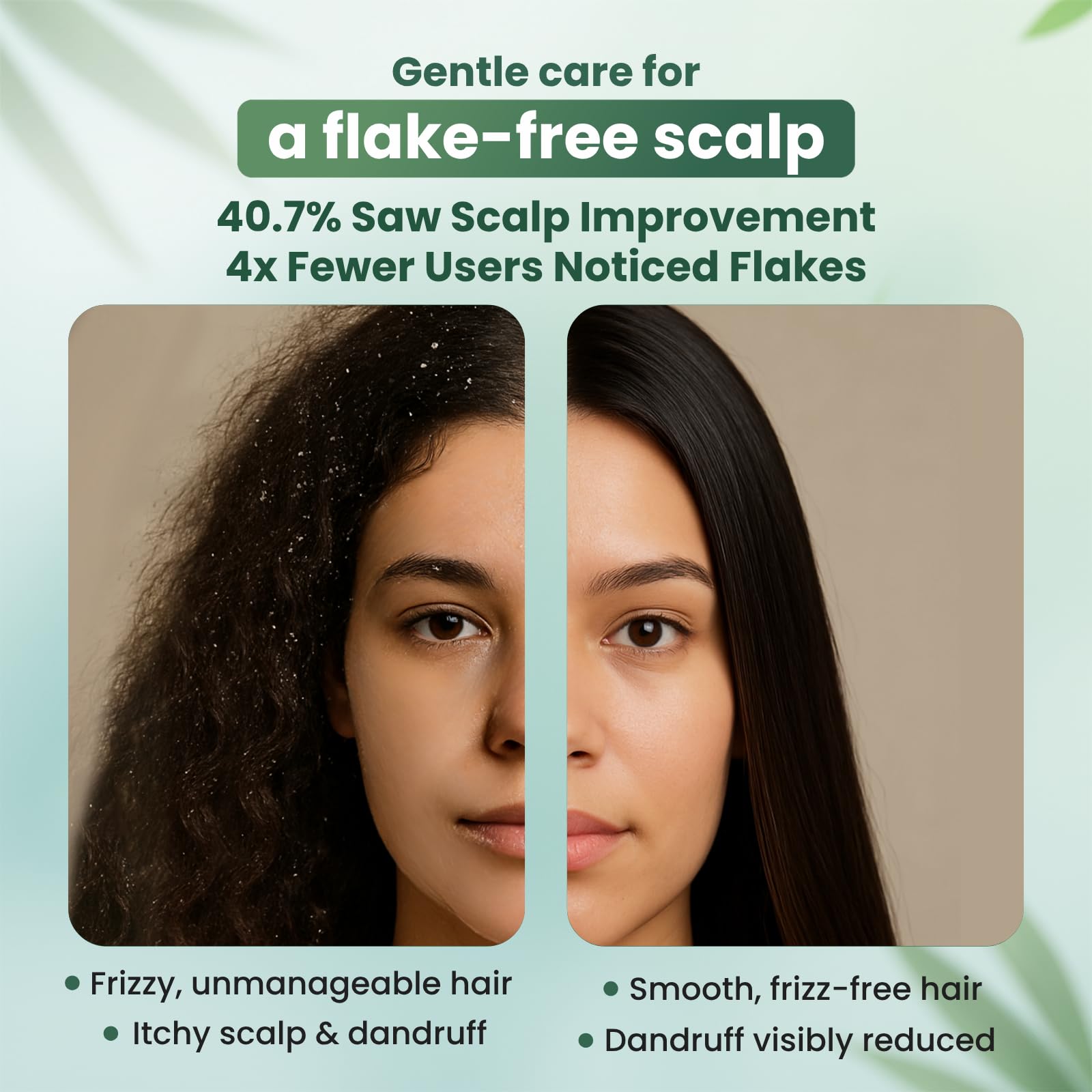 Moist Diane dry scalp relief shot with reduced flakes