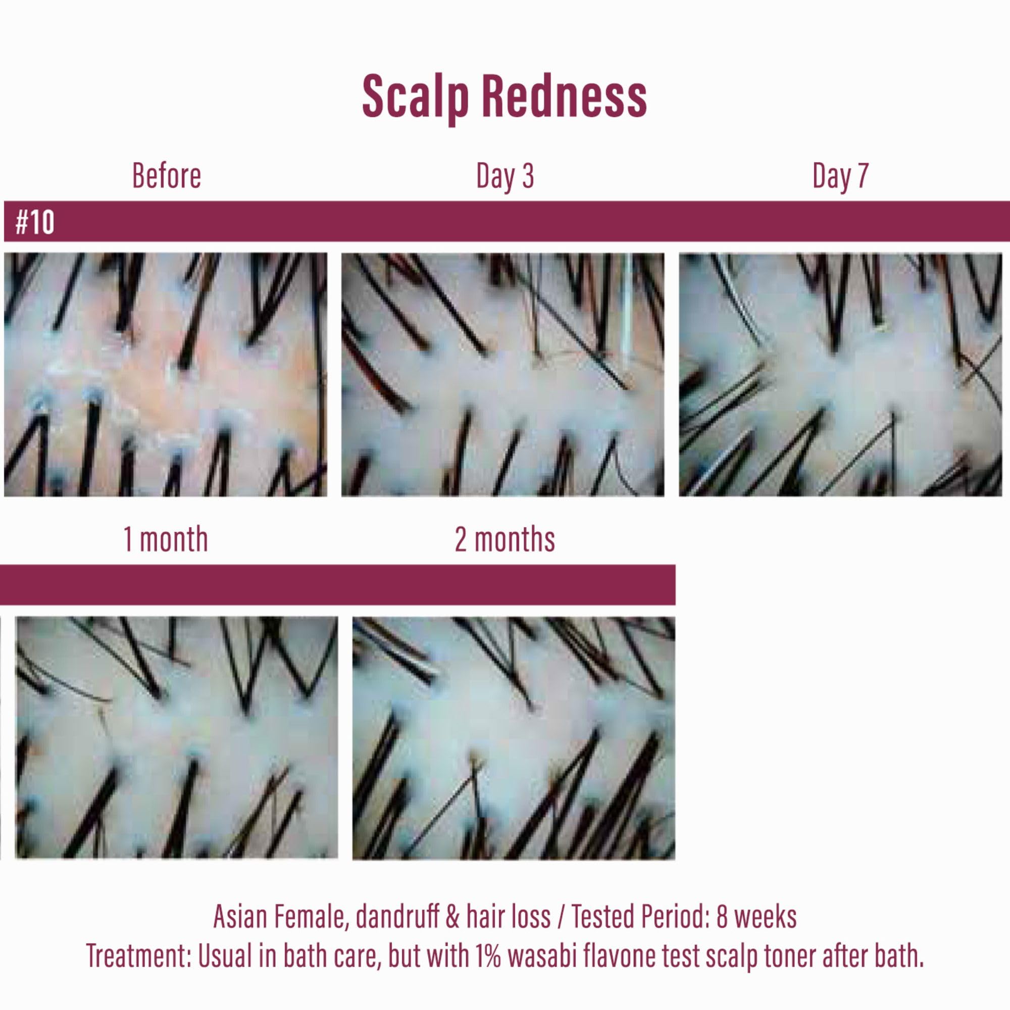 Moist Diane keratin scalp nourishment application image indicates stronger hair.