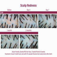 Moist Diane keratin scalp nourishment application image indicates stronger hair.
