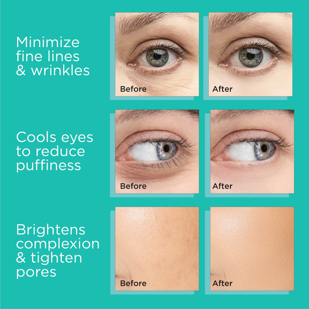MonétBeauty stainless steel globes provide long-lasting cold therapy.
