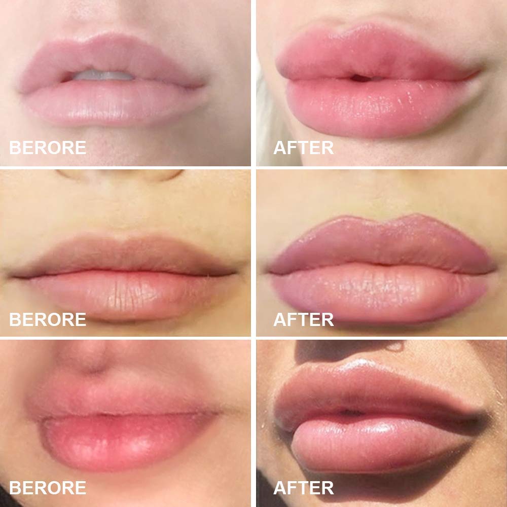 MonLiya Lips Enhancer usage step3 illustrates gradual suction and hold