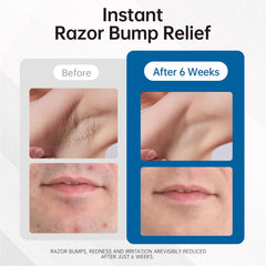 Morovan fast-absorbing-serum application demonstrates quick, non-greasy use.