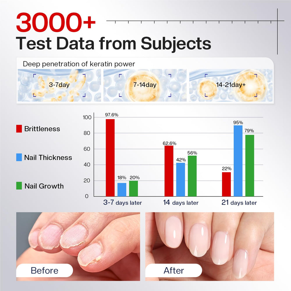 Morovan-nail-growth-vitamin-boost supports healthier growth with nourishing vitamins.