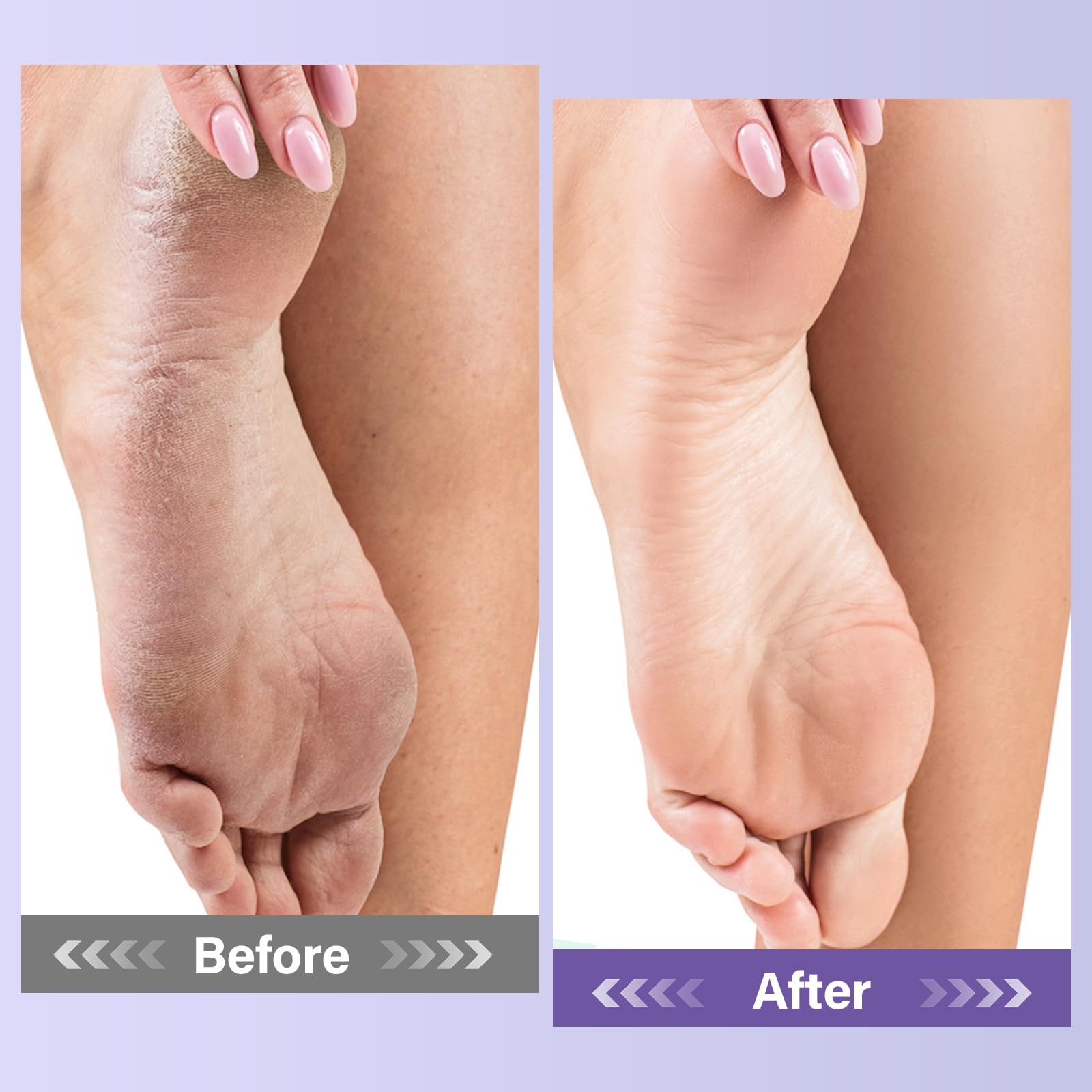 MOSRROU ergonomic pedicure tools designed for comfortable handling
