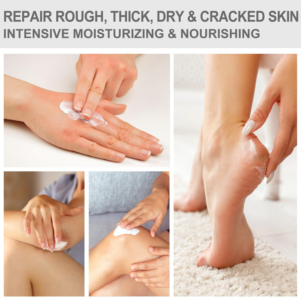 Mouriven Urea Cream 40% exfoliating feet to remove dry skin