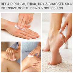 Mouriven Urea Cream 40% exfoliating feet to remove dry skin