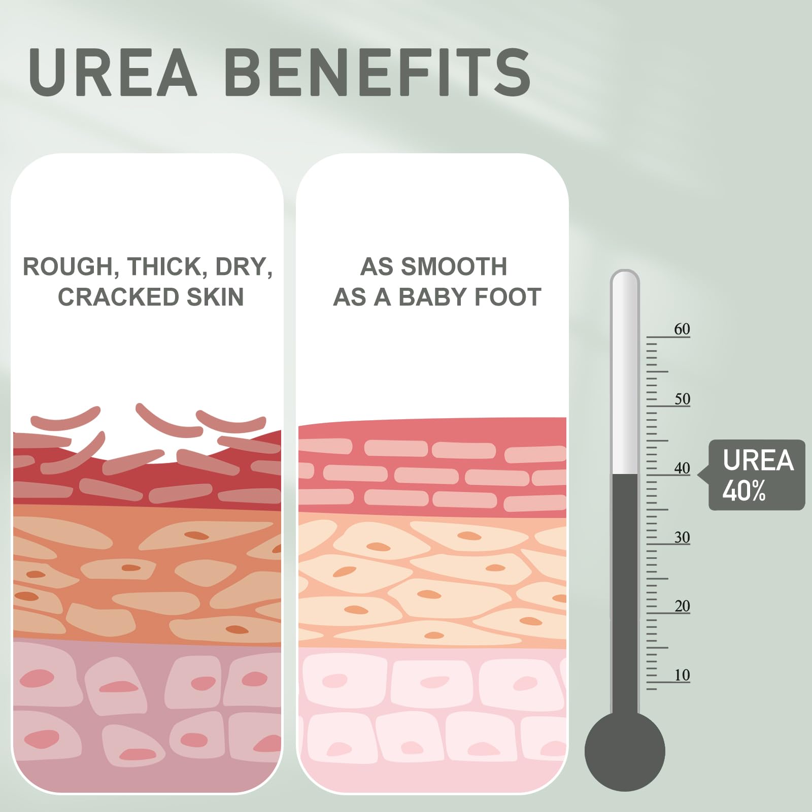 Mouriven Urea Cream 40% on knees and elbows softening rough areas