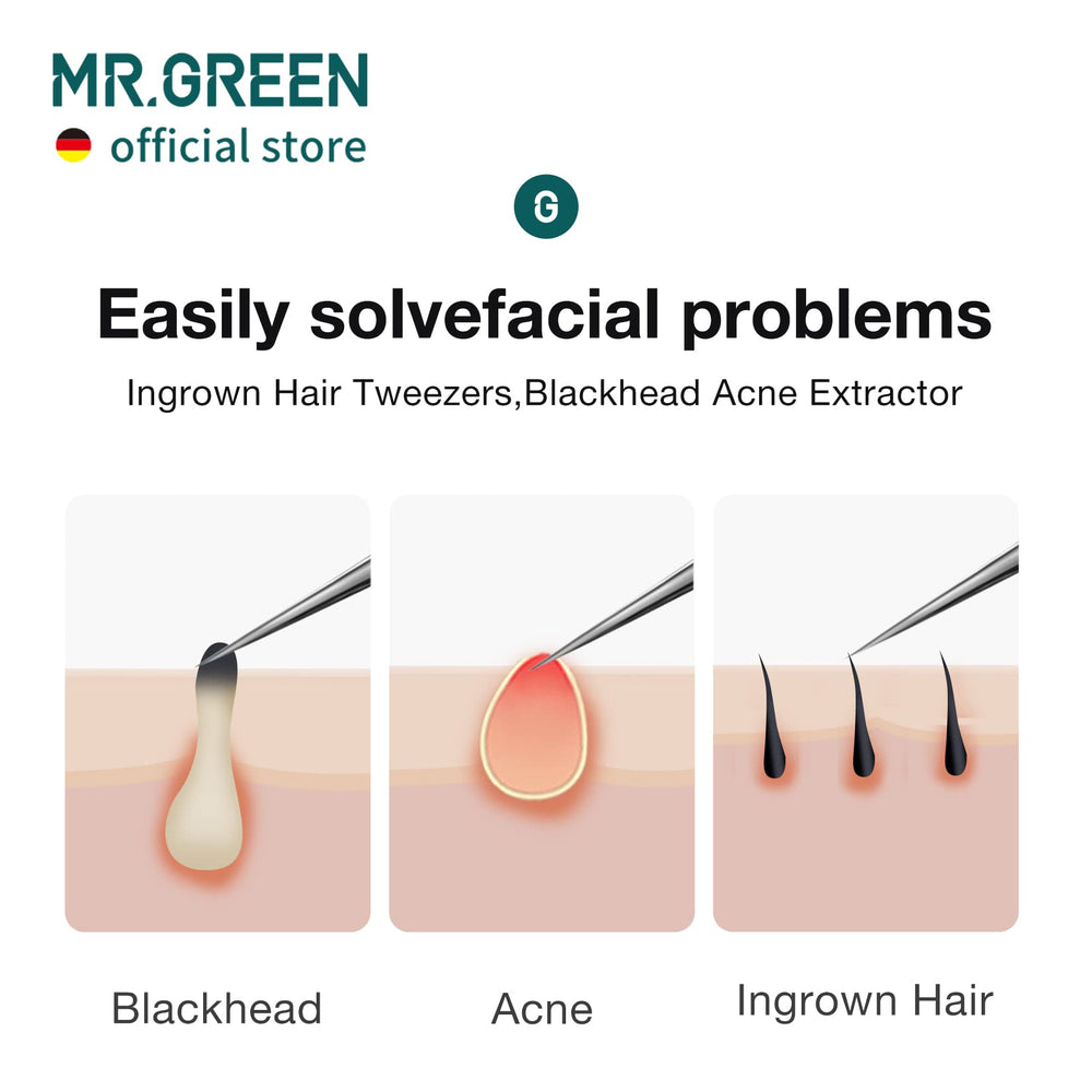 MR.GREEN precision tips engineered in Germany support tight grip and precise placement.