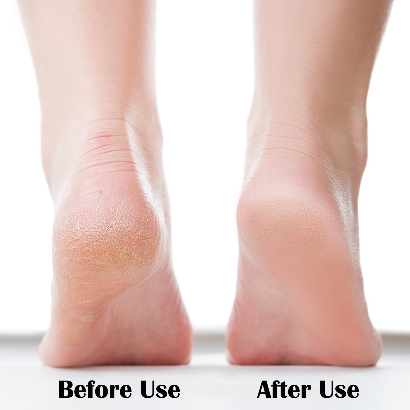 MR LION Nano Foot File with ergonomic grip provides comfortable control