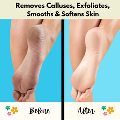 Mr. PUMI Bar ridged side for tougher callus removal