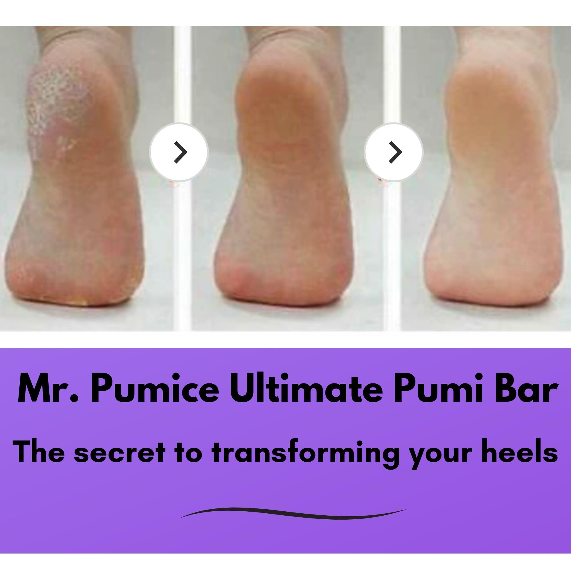Mr. Pumice Ultimate PUMI Bar medium-grit side for gentle exfoliation
