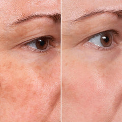 MSGBcg Ageless Rejuvenate with vitamin C visible on dropper