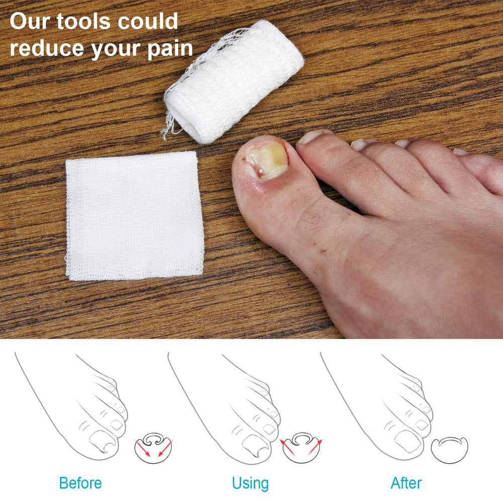Mudder portable, easy-to-use nail lifter in gold for travel