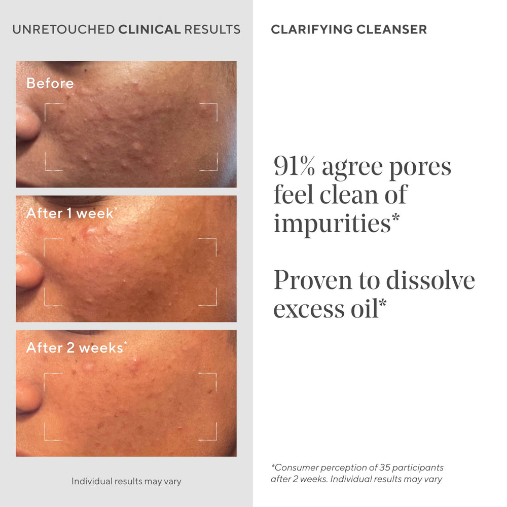 Salicylic acid close-up beside green tea leaves in Murad cleanser