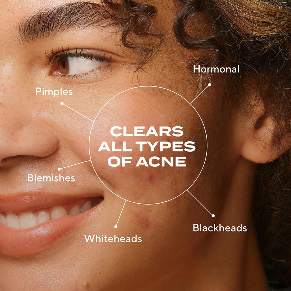 Murad Biome-Balancing Acne Serum texture swatch demonstrates light, non-greasy finish.