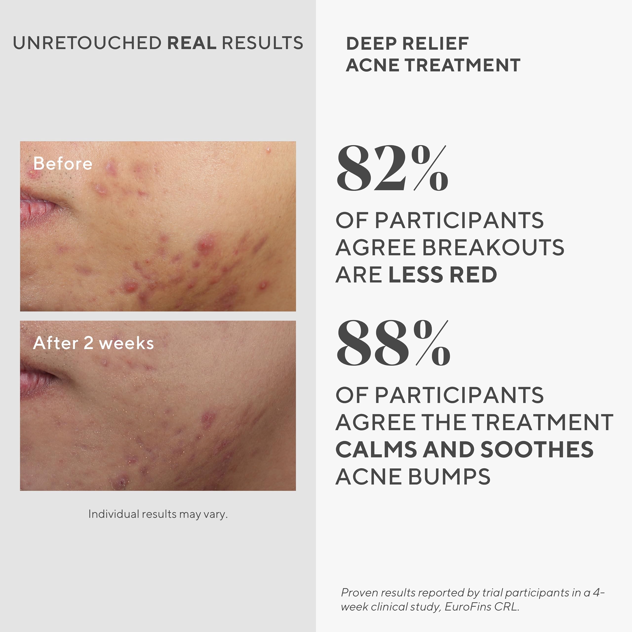 Murad Deep Relief cream texture swirl indicating soothing application.