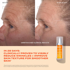 Murad Rapid Dark Spot Serum ingredient list highlighting tranexamic and glycolic acids.