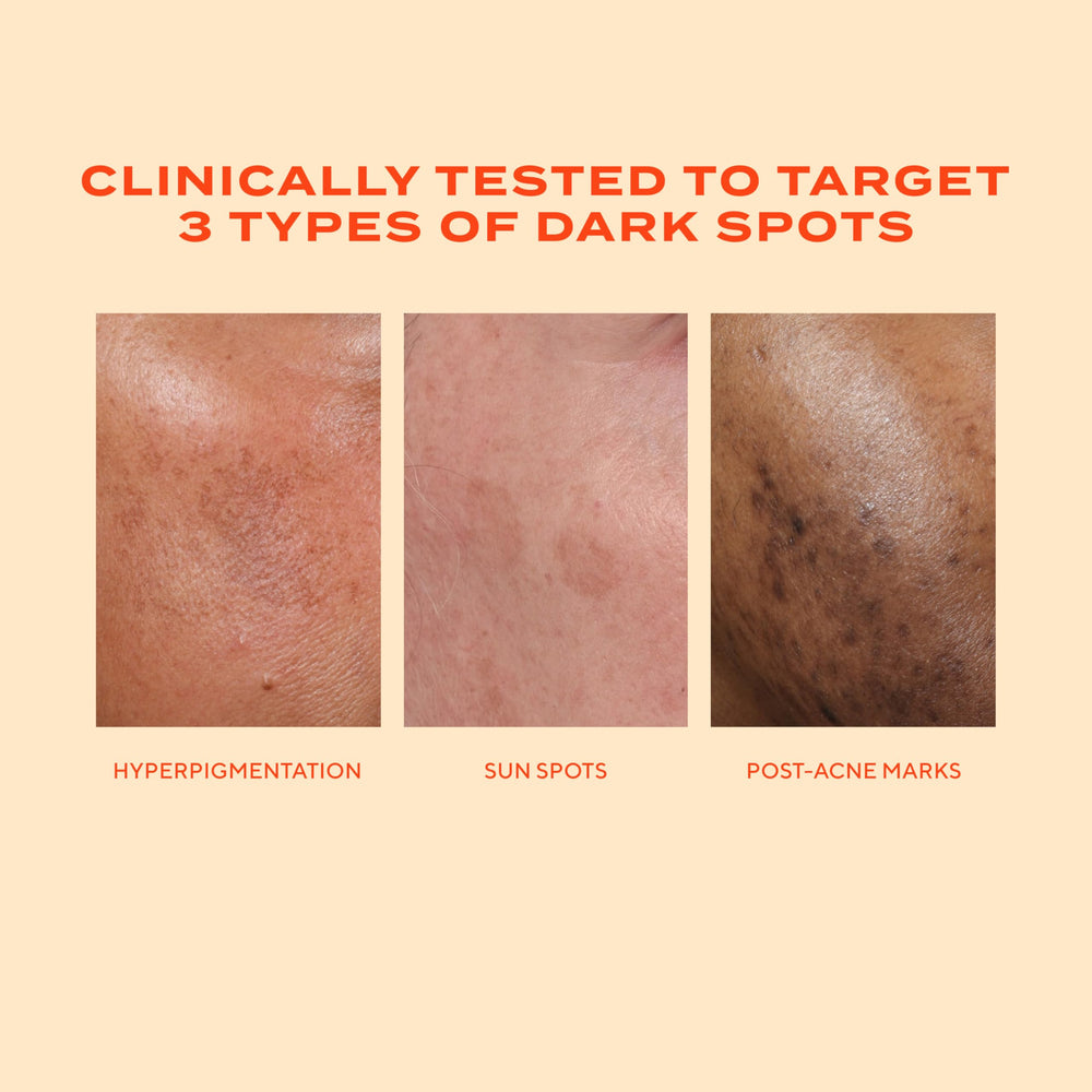 Murad Rapid Dark Spot Serum applied on cleansed facial skin.
