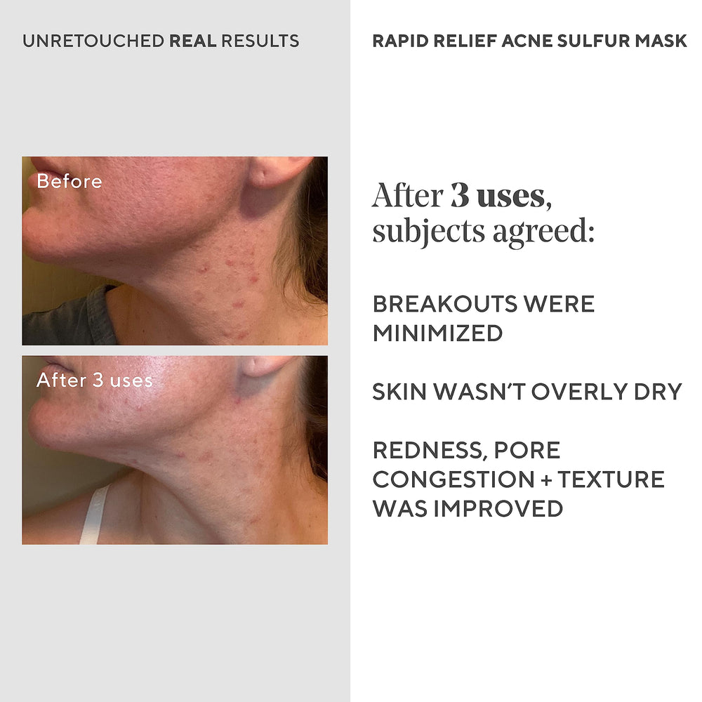 Rinsing off the mask to reveal refreshed pores