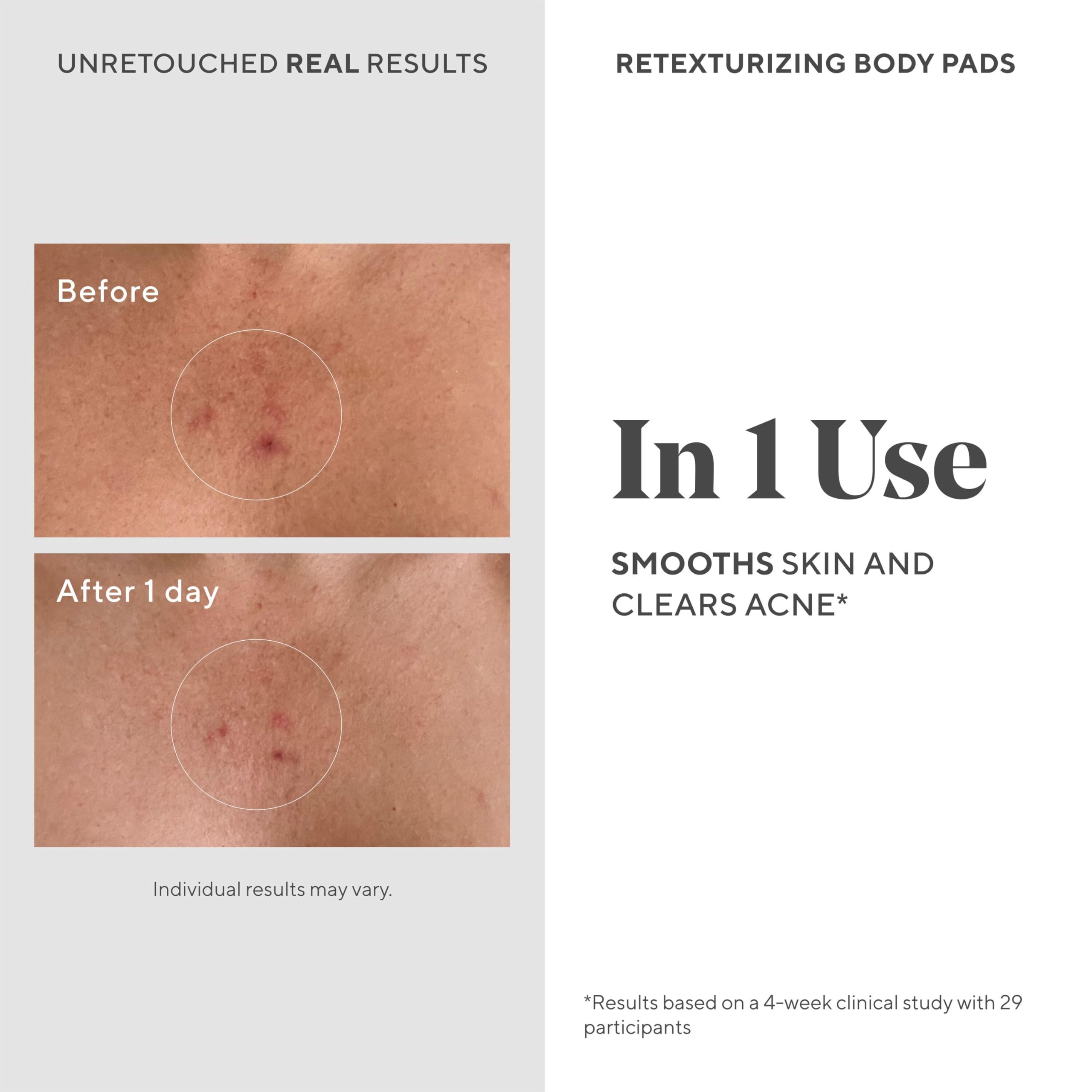 Murad Retexturizing Body Pads on a smooth leg with improved texture.