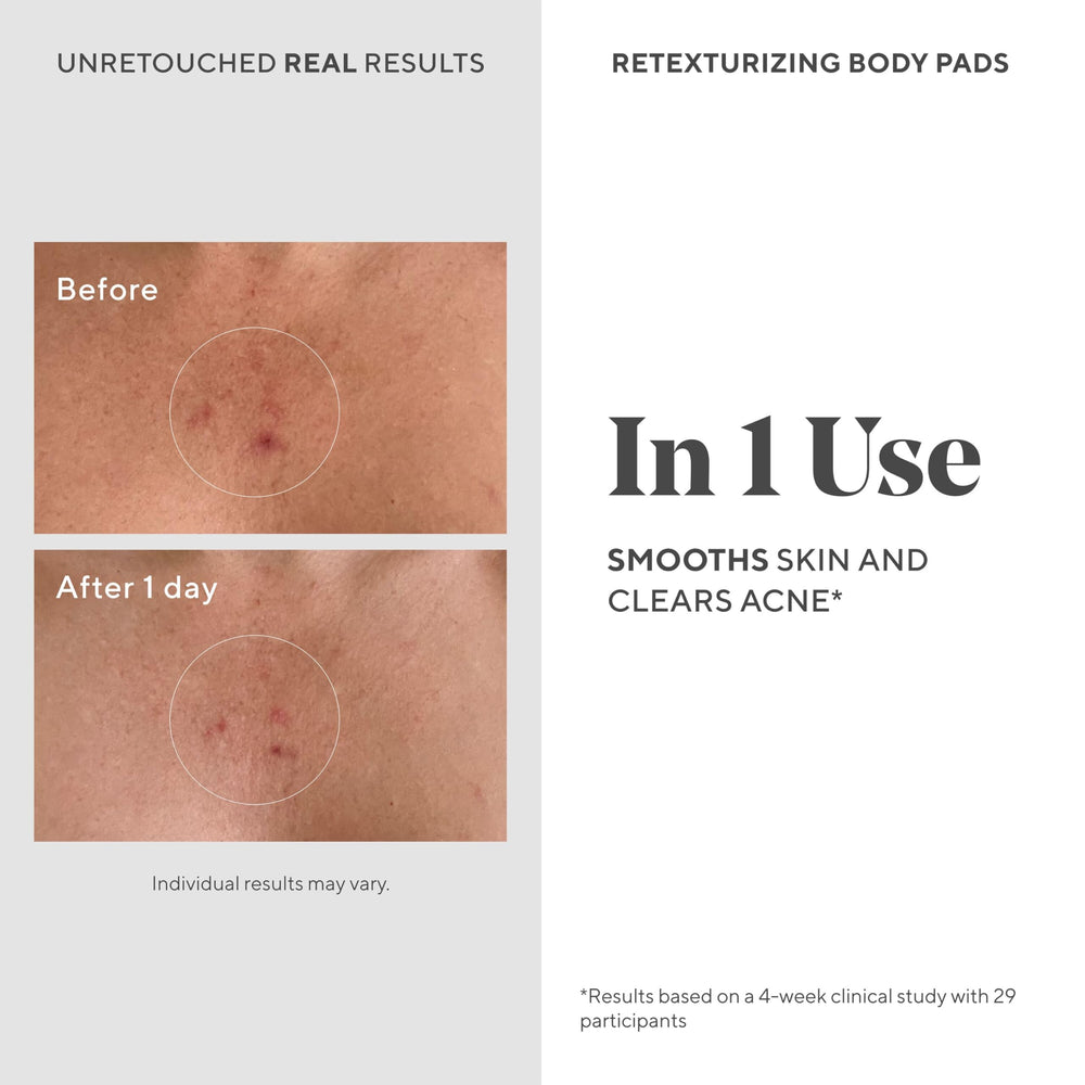 Murad Retexturizing Body Pads on a smooth leg with improved texture.