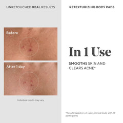 Murad Retexturizing Body Pads on a smooth leg with improved texture.