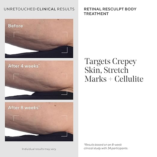 Murad Retinal ReSculpt crepey skin area with smooth, hydrated appearance